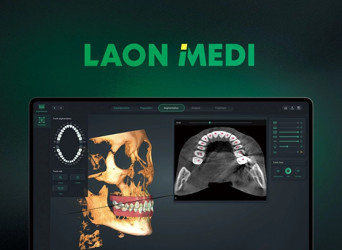 라온메디-[덴탈] 3D 알고리즘 개발자