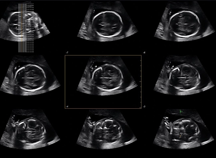 알피니언메디칼시스템-SW개발팀 Platform파트/초음파 진단 장비 소프트웨어 개발